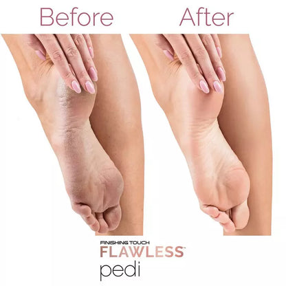 Flawless Pedi™