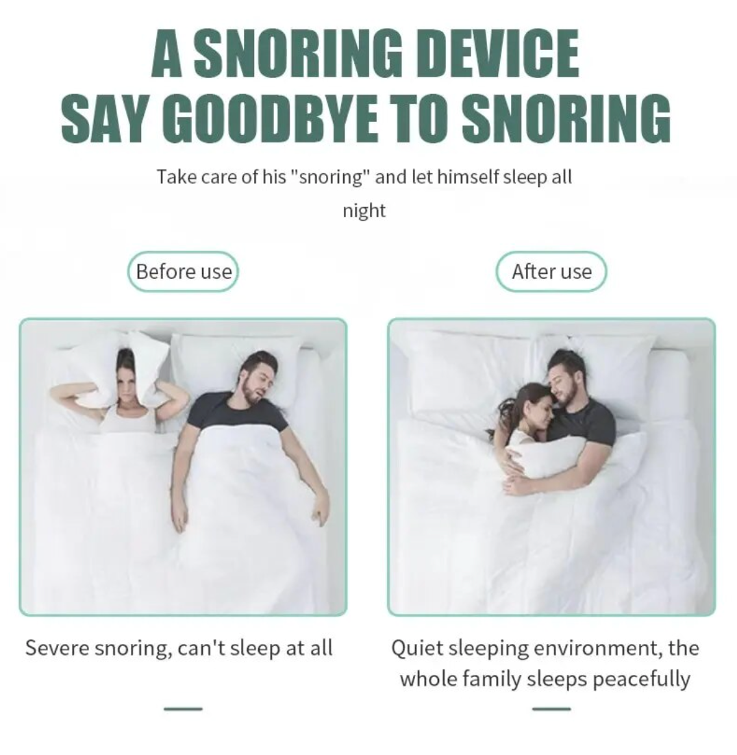 Anti-Snoring Device™